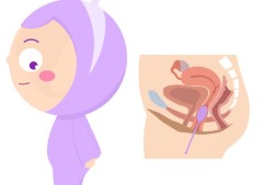 引道工程是什么意思引道結(jié)構(gòu)圖